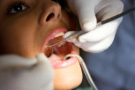 <div class="caption-credit"> Photo by: Babble</div><div class="caption-title">Dental Screening</div>Oral cancer is one of the six most common among adults, and semi-annual dental screenings throughout a lifetime can help detect its presence as well as combat gum and tooth decay. The Oral Cancer Foundation says "historically the death rate associated with this cancer is particularly high not because it is hard to discover or diagnose, but due to the cancer being routinely discovered late in its development." Pregnant women as well as smokers and those who take oral contraceptives are more prone to gum inflammation or disease. Depending on the results, the dentist might recommend more frequent visits.