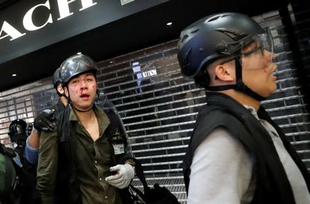 Injured plainclothes police officers are pictured after a march at Sha Tin District of East New Territories, Hong Kong