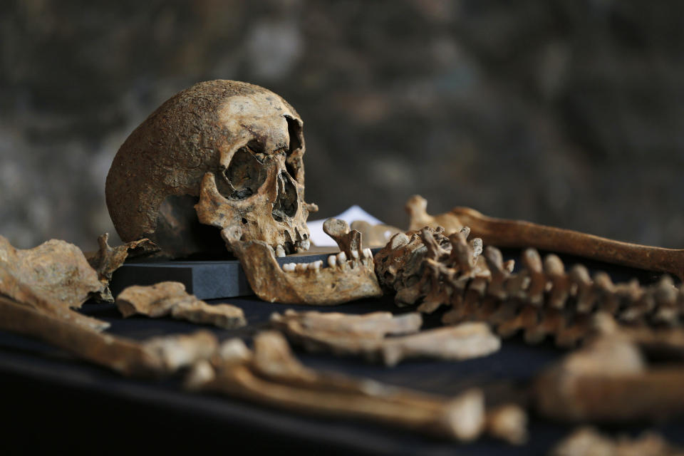 In this Wednesday, March 26, 2014 photo, one of the skeletons found by construction workers under central London's Charterhouse Square is pictured. Twenty-five skeletons were uncovered last year during work on Crossrail, a new rail line that's boring 13 miles (21 kilometers) of tunnels under the heart of the city. Archaeologists immediately suspected the bones came from a cemetery for victims of the bubonic plague that ravaged Europe in the 14th century. The Black Death, as the plague was called, is thought to have killed at least 75 million people, including more than half of Britain's population. (AP Photo/Lefteris Pitarakis)