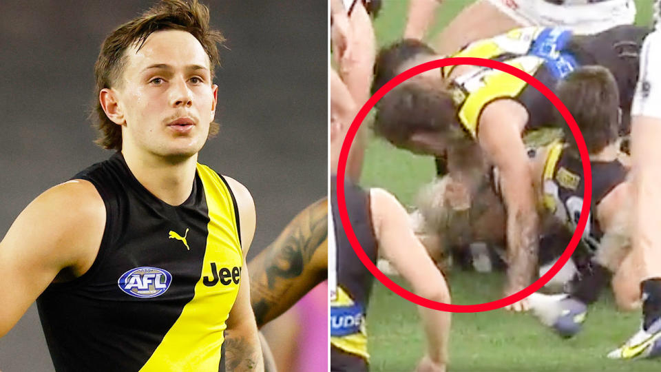 Pictured right, the ugly incident against Collingwood from Richmond's Rhyan Mansell.