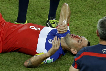 Clint Dempsey was left with a bloody nose after being kicked in his face. (AP)