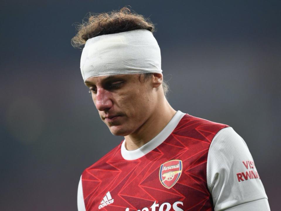 <p>David Luiz plays on despite a horrific clash of heads with Raul Jimenez</p> (Arsenal FC via Getty Images)