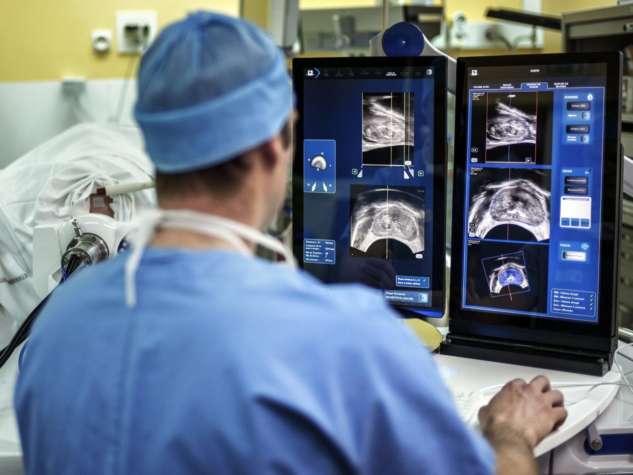 A surgeon sitting in front of screens of a Focal One device performs a robot-assisted prostate tumorectomy using ultrasound imaging on April 10, 2014 at the Edouard Herriot hospital in Lyon, center France.