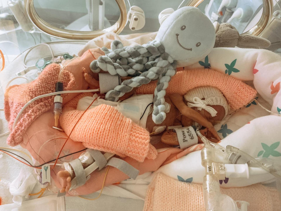 A tiny Marley with her octopus toy in hospital. (Sophie Louise James/SWNS)