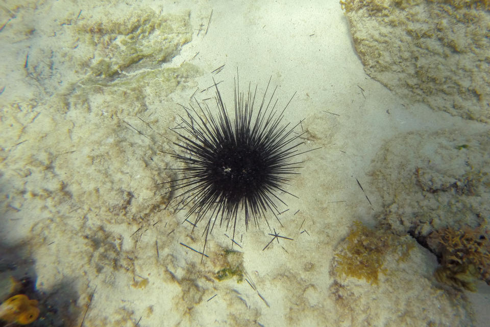 This photo provided by researchers shows spines falling off a ciliate parasite-affected sea urchin in Aruba in August 2022. A tiny single-celled organism is to blame for a massive die-off of sea urchins in the Caribbean in 2022, researchers reported Wednesday, April 19, 2023, in the journalScience Advances. (Ian Hewson/Cornell University via AP)