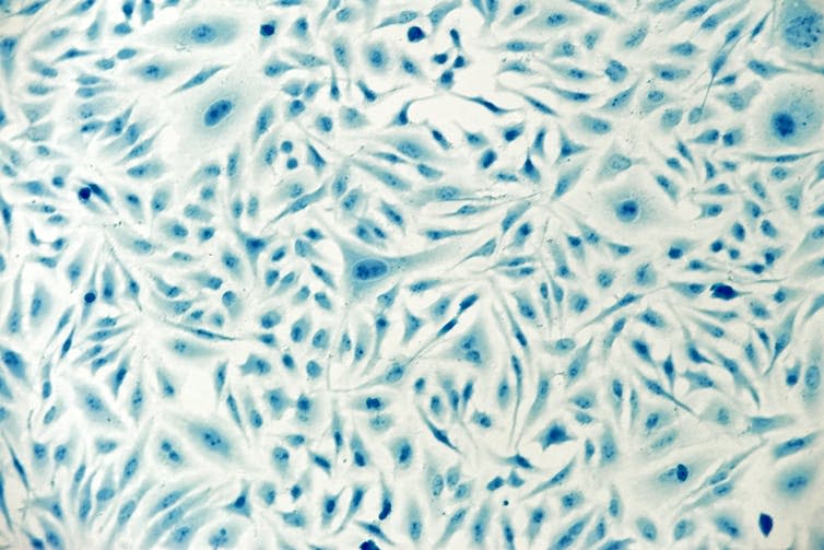 A stained slide showing Hela cells