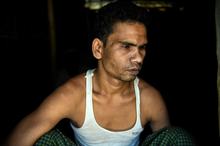 Mohammed Sultan, 30, went blind after a bullet pierced his right temple and severed his optical nerve