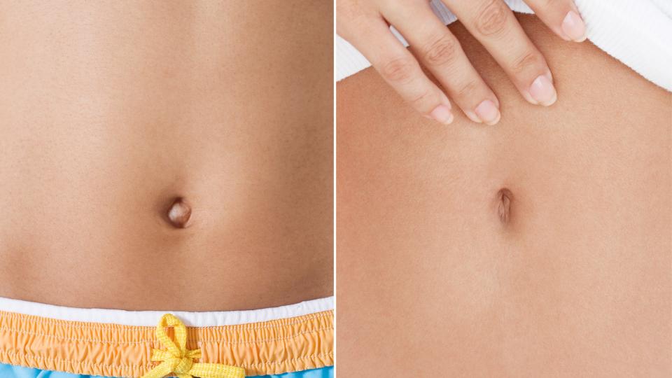 We asked plastic surgeons about the basics of belly button plastic surgery and why people are getting the procedure done as summer approaches.