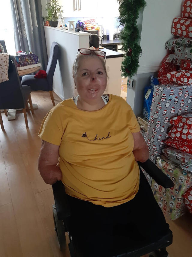 Dundee mum launches fundraiser for hubby who lost leg after being