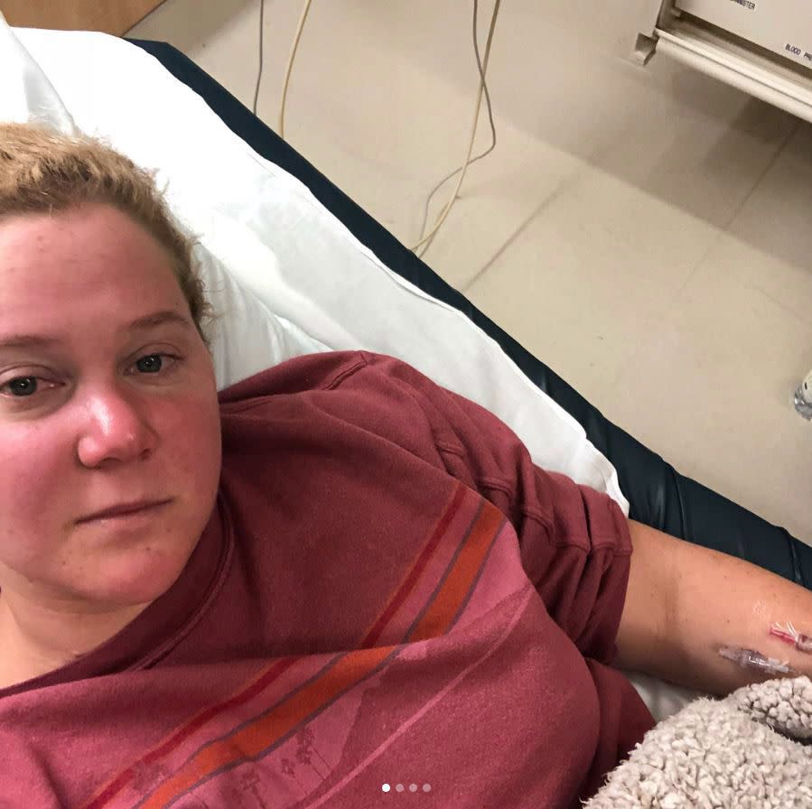 Amy Schumer had to cut promotion for her new film "I Feel Pretty" short earlier this week when she suffered from a kidney infection. The comedian, who was scheduled to fly to London, instead found herself hospital bed-ridden. "Here's what I've been up to this week," she captioned an Apr. 27, 2018 selfie from said hospital bed, which also angled to show needles inserted into her arm. "I was hospitalized for 5 days with a horrible kidney infection. I want to give a big thank you to the doctors, the bad ass nurses also my husband who's name is, i want to say, Chris? and my sisters Kimby and mol who have been by my side the whole time. I wanted to share this with you because this is sexy as hell but mostly because I was meant to go to London for the opening of I Feel Pretty and my doctors have told me that’s a no go. I'm really disappointed selfishly to miss this trip because I love London and Europe in general and all the great people (food) there. But I need to put my health first. I am so grateful for all the support the movie is getting. I hope people check it out in England and everywhere else in the world. It's sweet and fun and you will walk out feeling better. Which is something I hope to feel soon too."