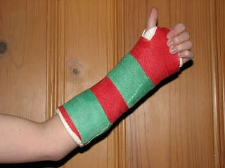 Arm in a cast