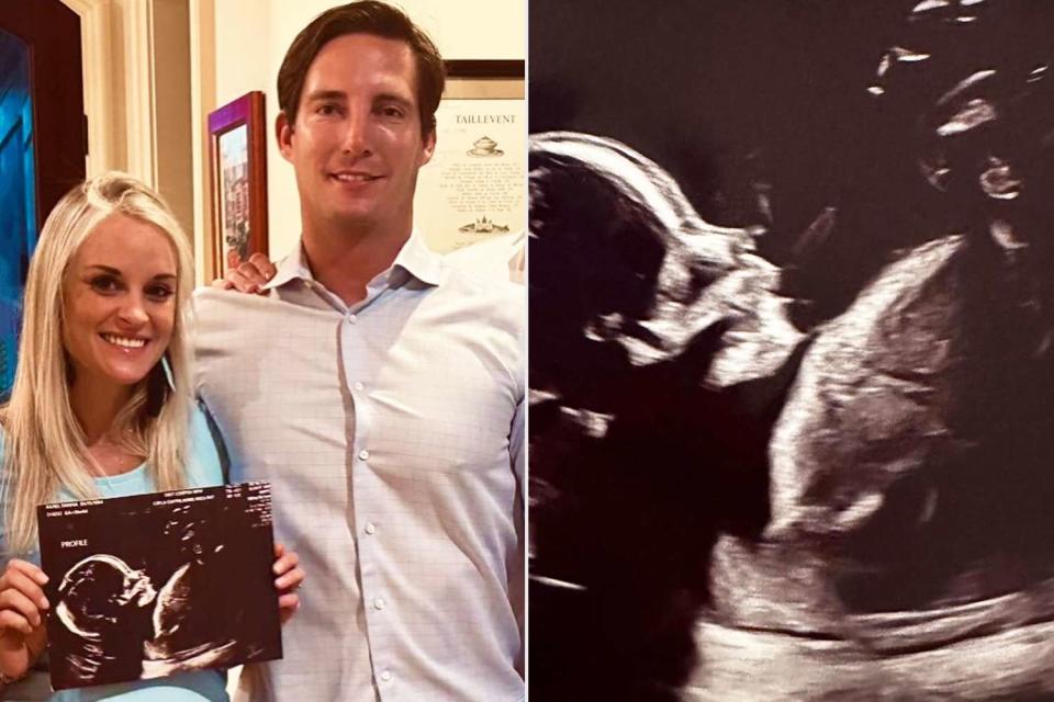 <p>Danni Baird/Instagram</p> Danni Baird and partner Nicholas Volz share ultrasound photo