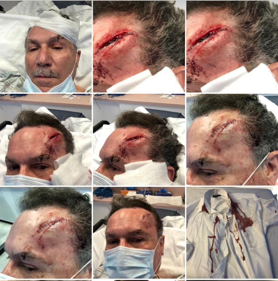 Acevedo, who ended up retiring in the wake of his bloody assault after 47 years at the store, was left with a gaping gash in his forehead.