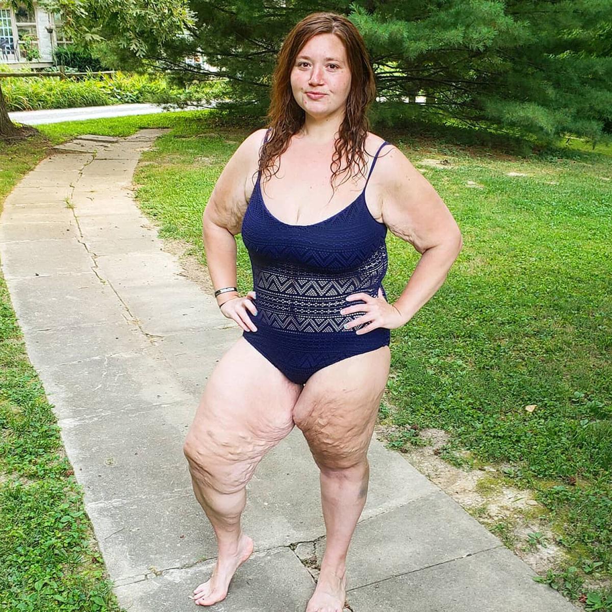 Influencer Lexi Reed Accepts Her Loose Skin in a Bathing Suit: 'One of My  Biggest Insecurities