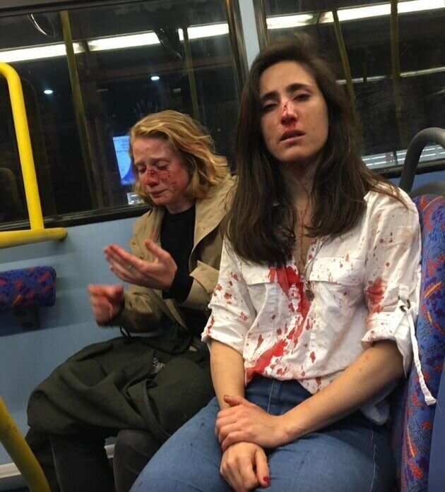 Lesbian couple Melania and Chris pictured covered in blood after the attack.