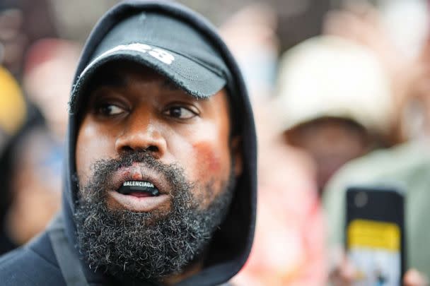 PHOTO: Kanye West aka Ye is seen wearing a Balenciaga boxing mouth guard, outside Givenchy, during Paris Fashion Week on October 2, 2022, in Paris, France. (Edward Berthelot/GC Images via Getty Images)