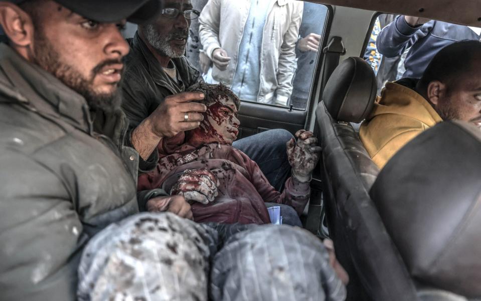 People transport a young injured Palestinian to hospital after an Israeli attack in Deir al-Balah, Gaza