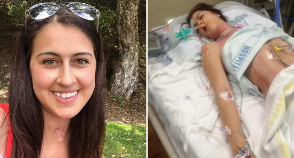 Left, Jessica Manning smiling after her heart and liver transplant. Right, Jessica Manning sick in the hospital before the transplant five years ago. 