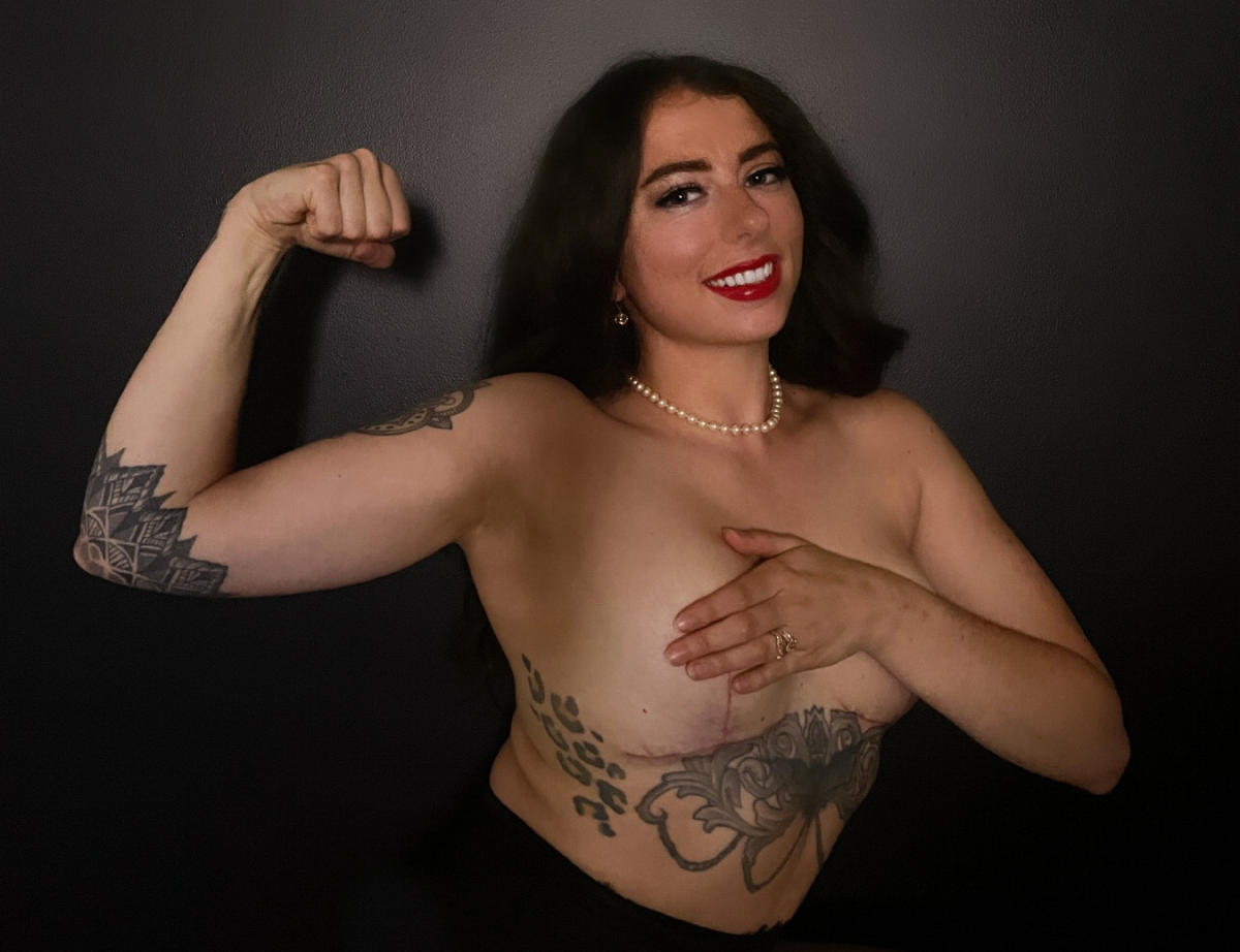 Women share why they decided to have breast explant surgery