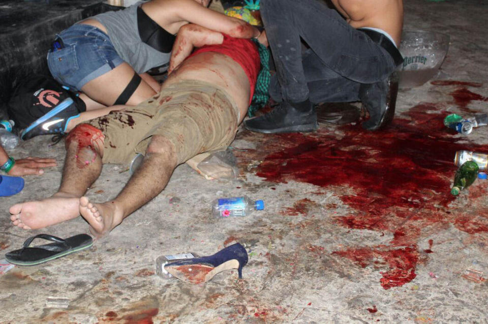 EDITORES: IMAGEN DE CONTENIDO GRAFICO. En esta fotografía del 16 de enero de 2017, difundida por el periódico Por Esto de Quintana Roo, un hombre yace herido después de una balacera durante un festival de música electrónica en la localidad turística caribeña de Playa del Carmen, en México. La balacera ocurrió en las primeras horas afuera de la discoteca Blue Parrot, cuando se efectuaba en el lugar un festival de música electrónica BPM, según la policía. (Por Esto de Quintana Roo, vía AP)