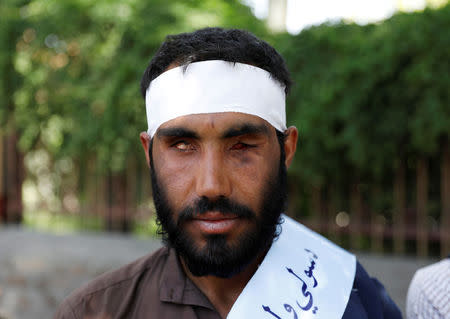 Zaheer Ahmad Zindani 27, a peace marcher who is disabled due to war, arrives in Kabul, Afghanistan June 18, 2018.REUTERS/Mohammad Ismail