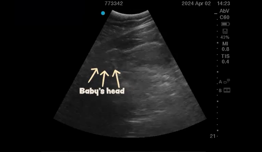 Baby animal ultrasound.