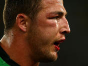 Sam Burgess suffeed a cheekbone injury in the first minute