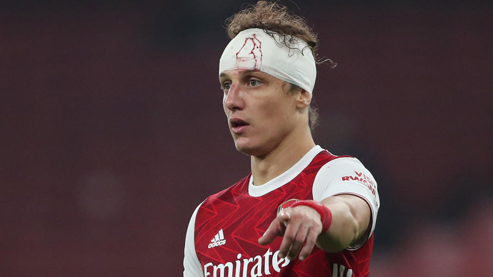 Arsenal's David Luiz was allowed to remain on the field despite a heavy cut sustained when he clashed heads with Wolverhampton's Raul Jimenez. (Photo by James Williamson - AMA/Getty Images)