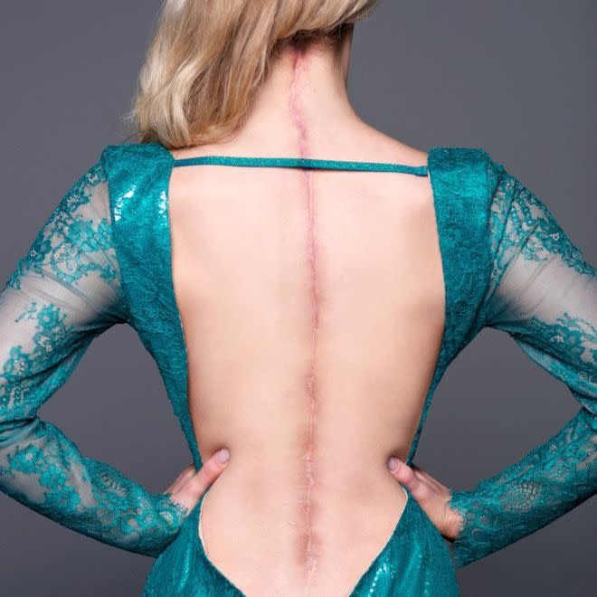 Victoria Graham hat das Ehlers-Danlos Syndrom – eine seltene genetische Erkrankung, die das Bindegewebe in der Haut, die Gelenke und die Blutgefäße betrifft. (Bild: AllyKat Photography)