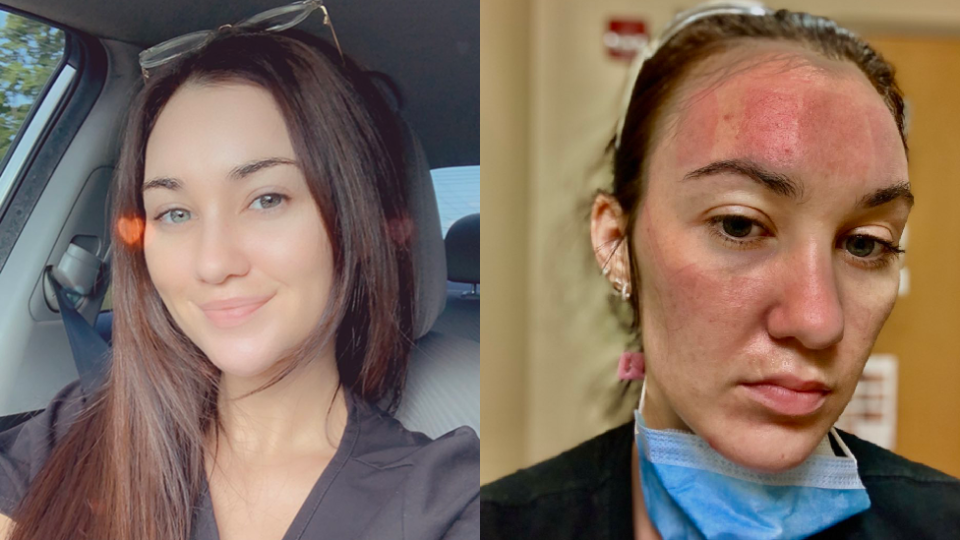 Nurse before and after coronavirus toll