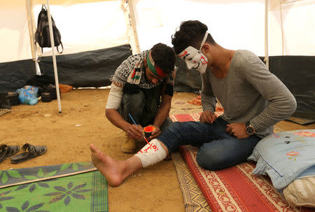 A wounded Palestinian has "Gaza" painted on his leg during a tent city protest at the Israel-Gaza border, in the southern Gaza Strip April 2, 2018. REUTERS/Ibraheem Abu Mustafa