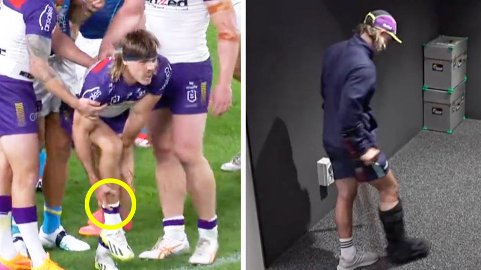Melbourne Storm defender Ryan Papenhuyzen (pictured) has suffered a fracture to his troublesome right ankle as the NRL world rallies around the defender.  (Images: Fox Sports)