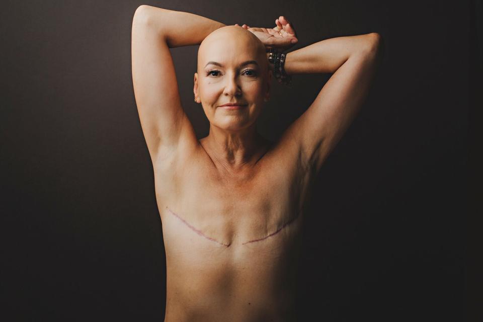 Ellyn Winters Is ‘Empowered’ Without Breast Reconstruction After Her Mastectomy: ‘I’m Not Hiding’