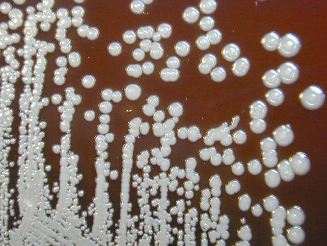 A Petri dish culture plate showing a colonial growth that resulted from a growth medium of sheep blood agar that was inoculated with Gram-positive Burkholderia pseudomallei bacteria before a 72-hour incubation period.  / Credit: CDC/ Courtesy of Larry Stauffer, Oregon State Public Health Laboratory