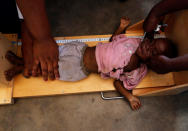 <p>A severely acute malnourished and internally displaced Congolese child is screened at the Tshiamala general referral hospital of Mwene Ditu in Kasai Oriental Province in the Democratic Republic of Congo, March 15, 2018. Picture taken March 15, 2018. (Photo: Thomas Mukoya/Reuters) </p>