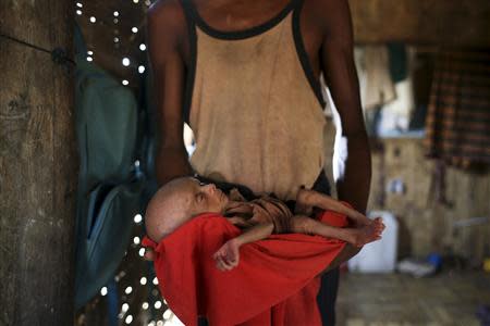 A boy holds his severely malnourished sibling in his room at the Dar Paing camp for internally displaced people in Sittwe, Rakhine state, April 24, 2014. REUTERS/Minzayar