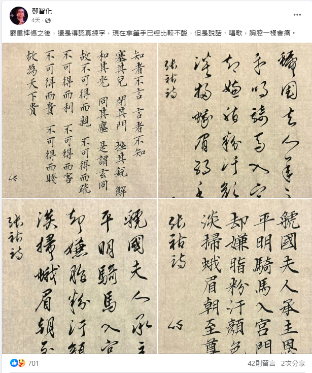 <strong>鄭智化透露意外摔傷。（圖／翻攝自鄭智化 臉書）</strong>