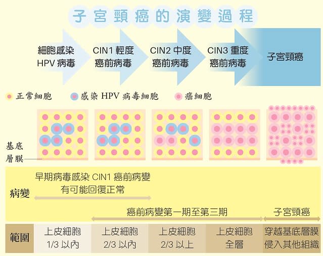 子宮頸癌的演變過程