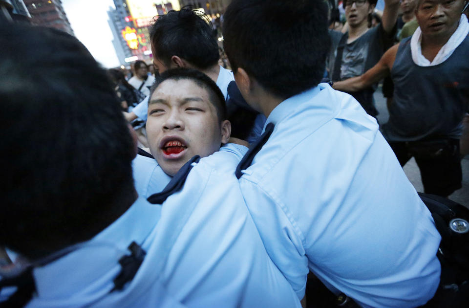 A student protester is injured after being pulled off and hit by residents and pro-Beijing supporters while local police are escorting him out of the protest area in Kowloon's crowded Mong Kok district, Friday, Oct. 3, 2014 in Hong Kong. (AP Photo/Wong Maye-E)