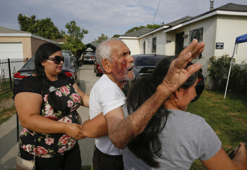 FILE - In this July 11, 2018, file photo, Aurelia Rodriguez, right, helps her father, Rodolfo Rodriguez, 92, center, with and witness, Misbel Borjas, left, as he walks back home after talking to members of the media gathered outside his home in Los Angeles. Rodriguez was out for a walk when he was beaten on the night of July 4 on a sidewalk in an unincorporated Willowbrook, a tough South Los Angeles neighborhood. Borjas made a video of Rodriguez moments later as he sat on the ground dazed, his face bloodied. The witness said the assailant struck him several times on the head with a brick. The Los Angeles County District Attorney's office says Laquisha Jones pleaded no contest to elder abuse Thursday, Dec. 27, 2018. She faces up to 15 years in prison at her sentencing on Feb. 28. (AP Photo/Damian Dovarganes, File)