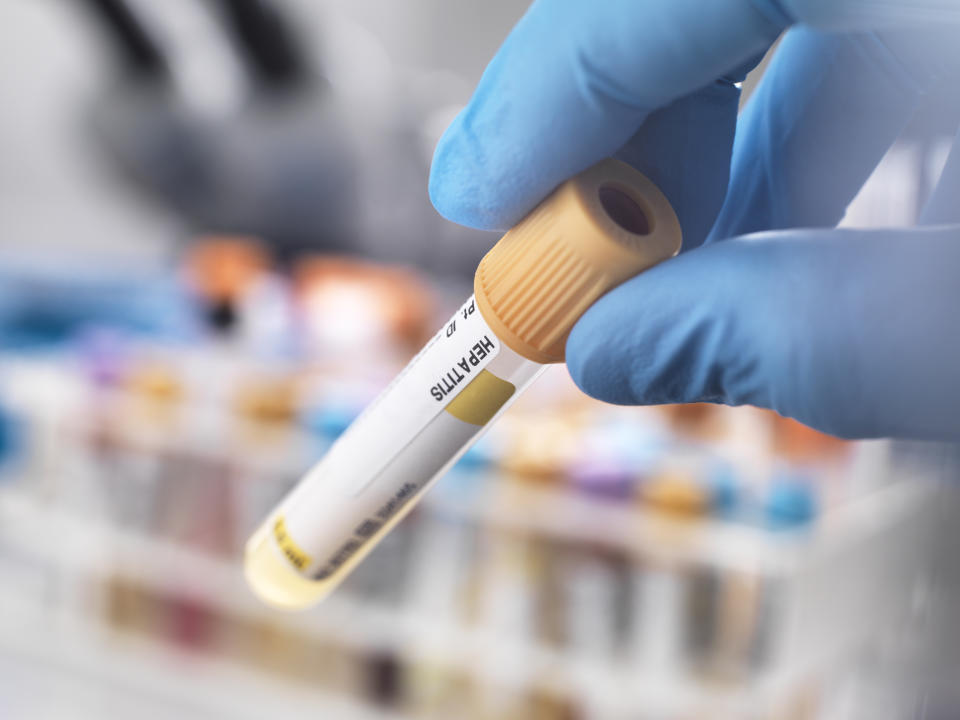 STI tests can range from urine samples, bloods tests and swabs, and might detect infections like chlamydia, syphilis or HIV. (Photo via Getty Images)