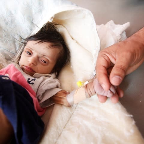 Nurse holds a hand of malnourished two-month-old Jood Motaher two days before her death at a malnutrition treatment centre in Sanaa - Credit: Reuters