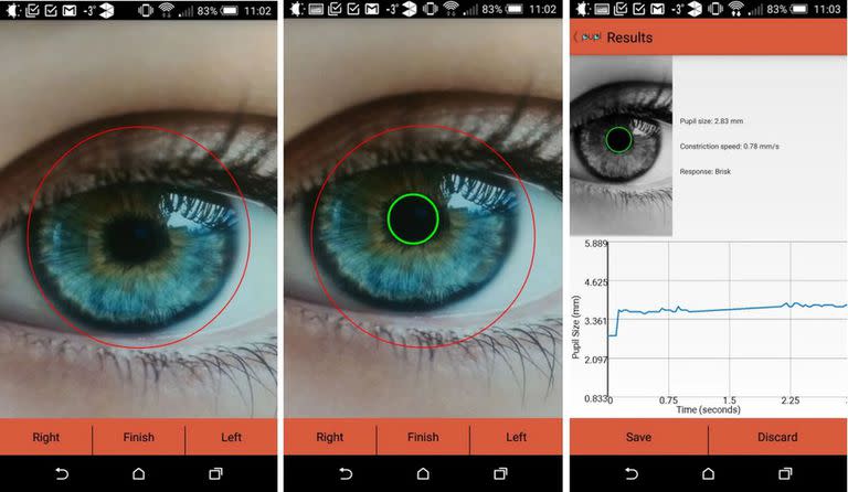 nvestigadores de la Universidad de California en San Diego han desarrollado una aplicación para teléfonos inteligentes para identificar, mediante primeros planos de los ojos, signos de alzhéimer, trastorno por déficit de atención e hiperactividad (TDAH) y otros trastornos neurológicos.