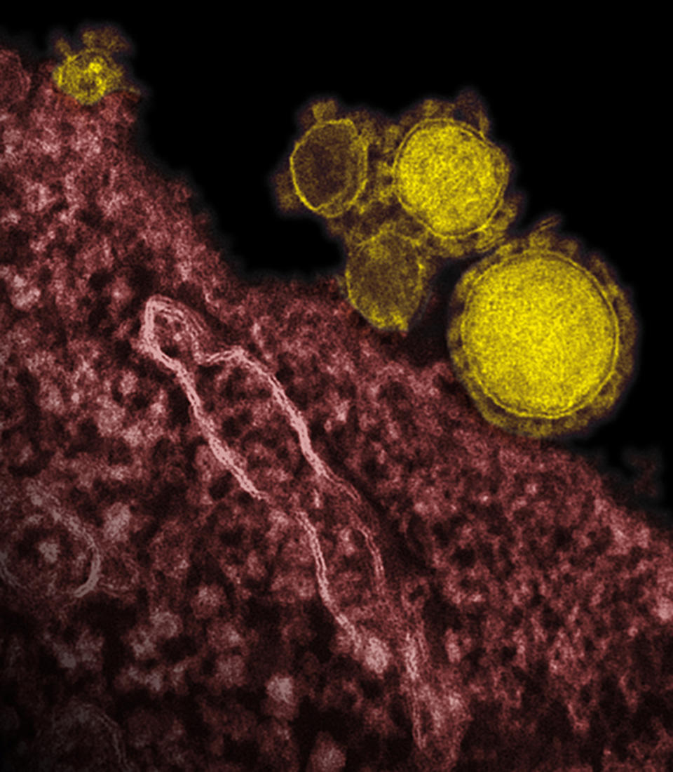 FILE - This undated file electron microscope image made available by the National Institute of Allergy and Infectious Diseases - Rocky Mountain Laboratories shows novel coronavirus particles, also known as the MERS virus, colorized in yellow. Four more people have died in Saudi Arabia after contracting an often fatal Middle East respiratory virus as the number of new confirmed infections in the kingdom climbs higher, according to health officials. The Saudi health ministry said in a statement posted online late Wednesday, May 8, 2014 that 18 new confirmed cases of the Middle East Respiratory Syndrome were reported in the capital Riyadh, the western cities of Jiddah, Mecca and Medina, and in the city of Najran, along the border with Yemen.(AP Photo/NIAID - RML, File)