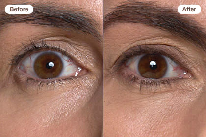 Erase 10 years: Define your eyes with a little liner and fill in your brows