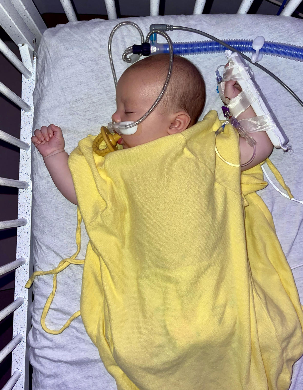 Baby Asa, 2 months, was hospitalized with RSV for four days as children's hospitals around the country face a surge in patients due to the respiratory virus. (Courtesy Shanisty Ireland)