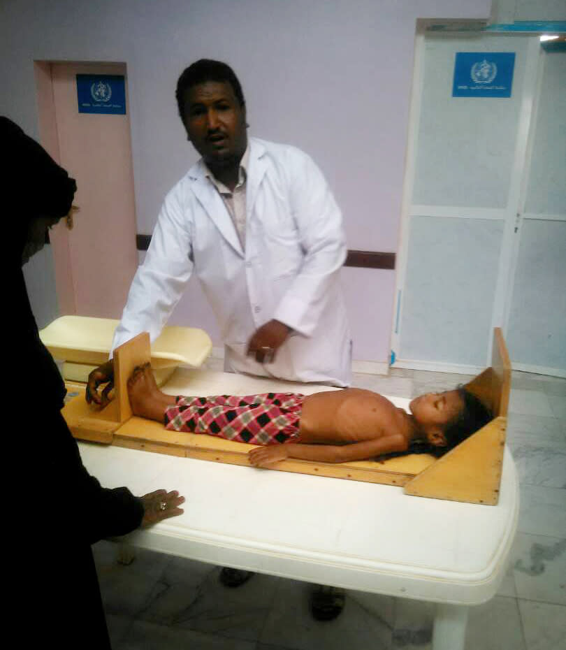 This undated 2018 handout image provided by Dr. Mekkiya Mahdi, Head of Aslam Health Center, shows severely malnourished Zaifa Shouib before her death at the Aslam Health Center in Hajjah, Yemen. Zaifa was as old as Yemen’s civil war, waged between rebels known as Houthis and a coalition led by Saudi Arabia. Born in the war’s early days, Zaifa succumbed to the humanitarian crisis it has caused _ widespread hunger, the collapse of the economy and the breakdown of the health system. (Courtesy of Dr. Mekkiya Mahdi via AP)