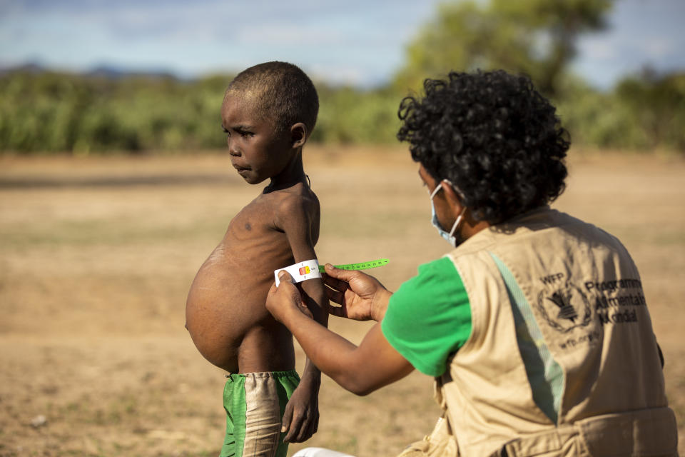 A worker measures the arm of a young child.