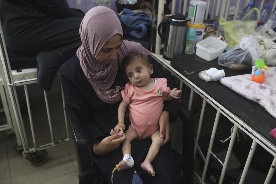 Amira Al-Jojo holds her son Yousef Al-Jojo, 10 months old, who suffers from malnutrition, at Al-Aqsa Martyrs Hospital, where he is undergoing treatment, in Deir al-Balah in the central Gaza Strip on Saturday, June 1, 2024. (AP Photo/ Jehad Alshrafi)