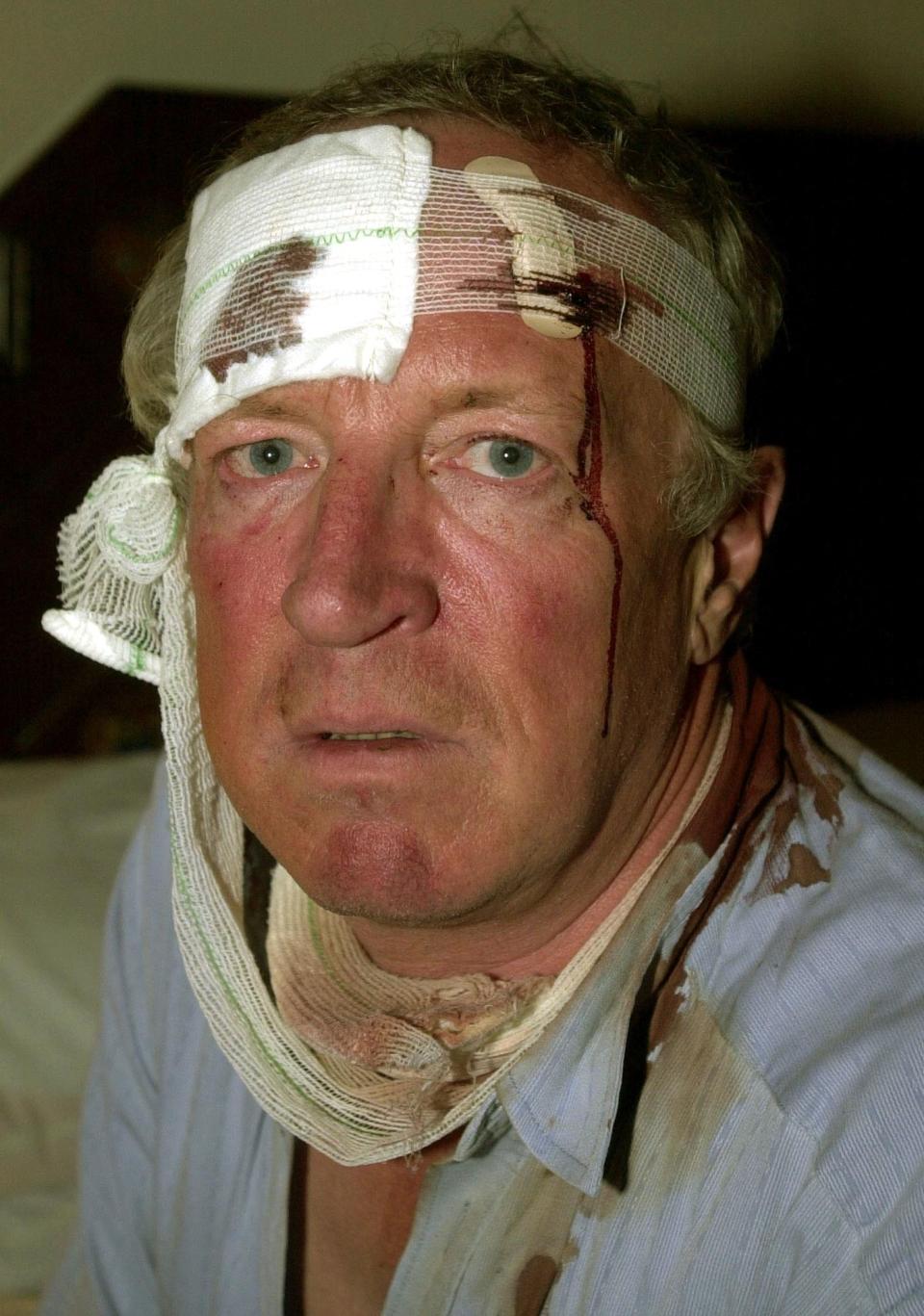 FILE - In this Dec. 8, 2001 file photo, veteran Robert Fisk, a British journalist working for the London daily, The Independent, is pictured in his hotel room in Quetta, Pakistan, after being beaten by a mob on the road linking the border town of Chaman to Quetta. Fisk, one of the best-known Middle East correspondents who spent his entire career reporting from the troubled region and won accolades for challenging mainstream narratives died Sunday at a hospital in Dublin after a short illness. He was 74. (AP Photo/Hussein Malla, File)